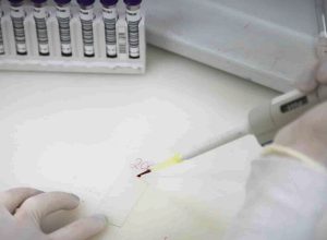 exames-descartam-ebola-em-imigrante-da-republica-democratica-do-congo